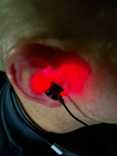 Click to view full screen ReHears photo review